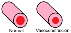 Representación de una sección transversal de un vaso sanguíneo normal y uno en vasoconstricción